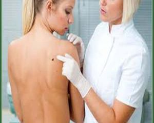 Read more about the article Moles and their significance
